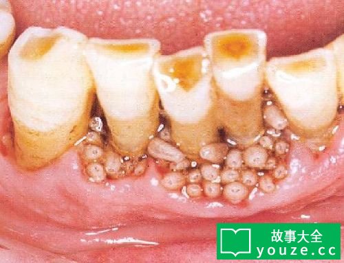 SCP611是什么?