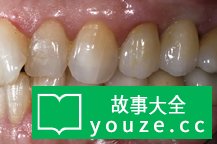 SCP2211是什么?