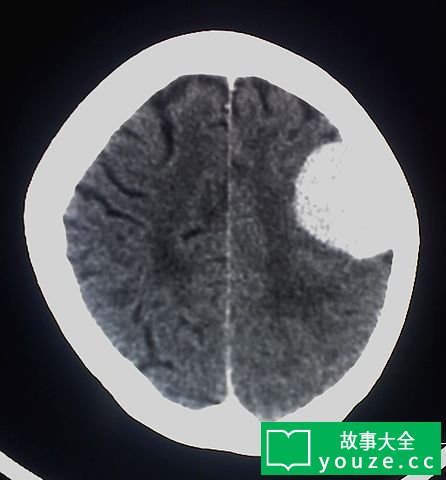 SCP2315是什么?