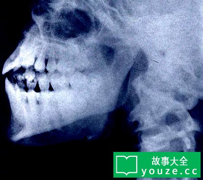 SCP2679是什么?