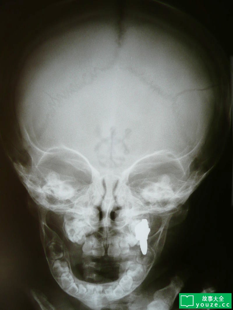 SCP2696是什么?