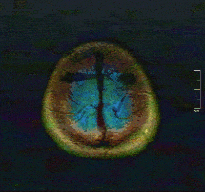 SCP4830是什么?