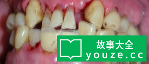 SCP4910是什么?