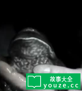 SCPCN337是什么?