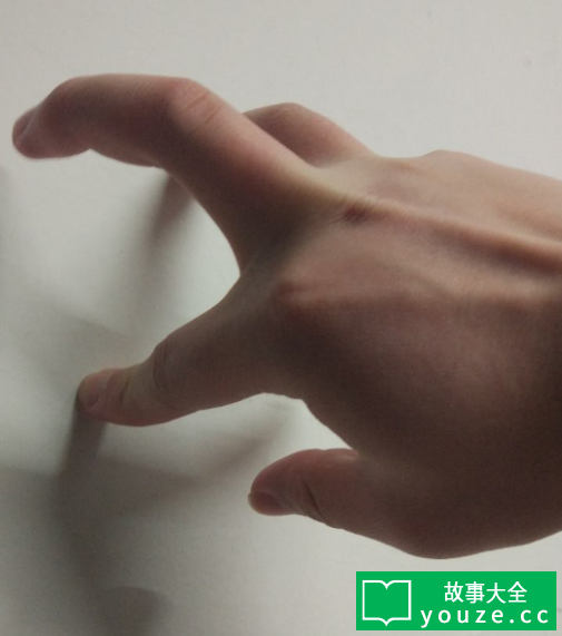 SCPCN354是什么?